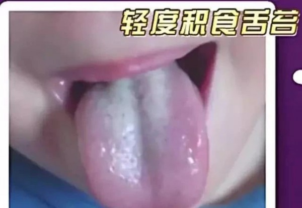 当宝宝表现出这些症状，很有可能积食了，怎么办？