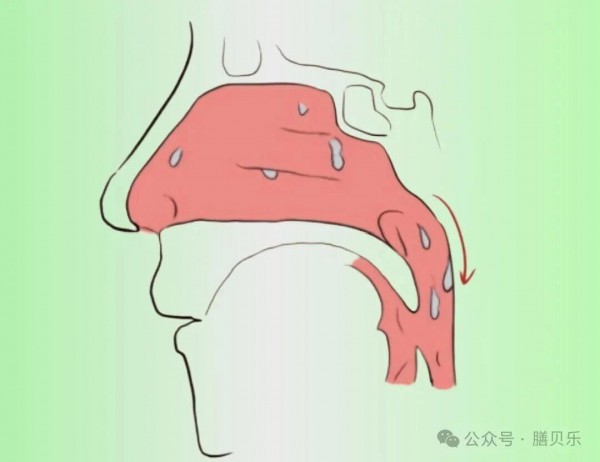 孩子喉咙“呼噜噜”？告别盲目化痰！