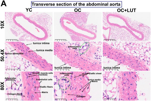 这种降尿酸的明星成分,还能延缓血管衰老! 这种降尿酸的明星成分,还能延缓血管衰老!