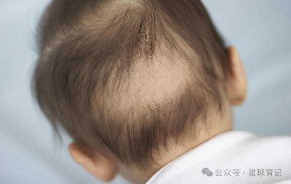 新生儿枕秃是因为缺钙吗？