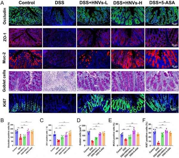 被誉为“清热解毒第一花”，这种药食同源能有效改善肠道炎症！