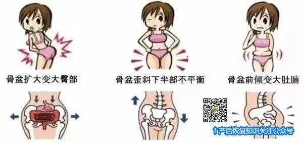 不做骨盆修复，老后的样子更可怕！！！