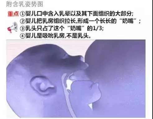 哺乳期乳头长小白点反复堵奶，该怎样处理和预防？