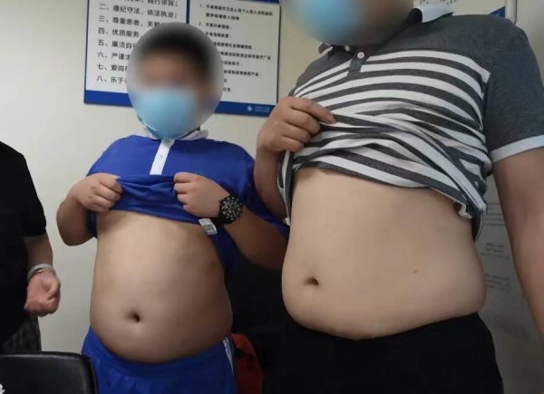 11岁男孩吃出重度肝硬化，只因吃饭时的一个习惯！大人也会犯，千万要重视！