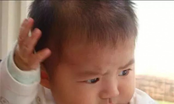 孩子总是挠头, 妈妈以为是天气太热, 大夫检查后直呼: 无知