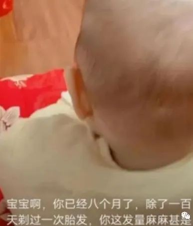 为啥有的宝宝出娘胎就头发茂密，长着长着就变黄了！