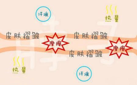 宝宝脖子淹了哭闹不止，竟是奶奶惹的祸，这种错误别再犯了