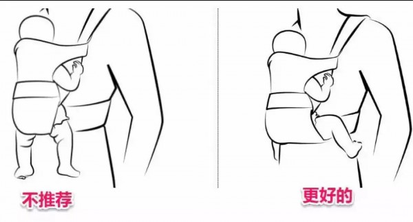 宝宝腿纹不对称怎么回事？腿纹不对称要不要紧？一文弄懂