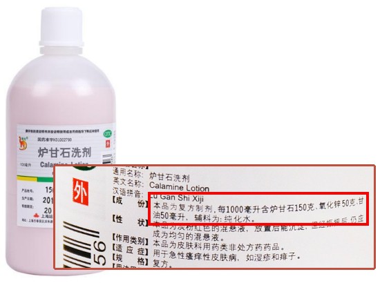 “万能”的炉甘石洗剂并非万能！这4种情况禁用！