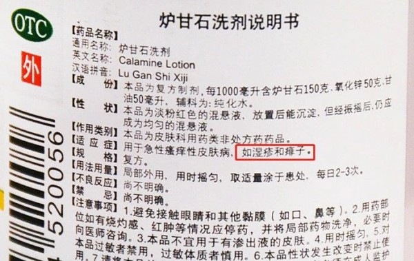 “万能”的炉甘石洗剂并非万能！这4种情况禁用！