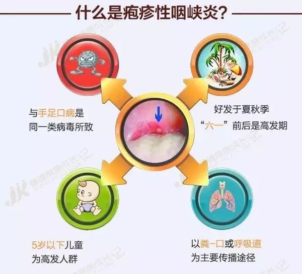 幼儿疱疹性咽峡炎进入高发期,请家长们注意!