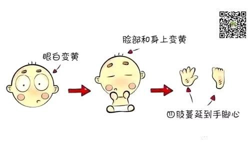 为什么母乳宝宝黄疸会偏高或持续更久？（推荐收藏）