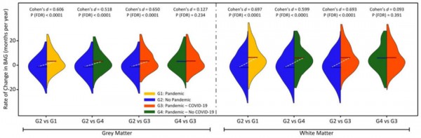 Nature实锤：我们的大脑竟“早衰”5.5个月！每个人或许都中招！