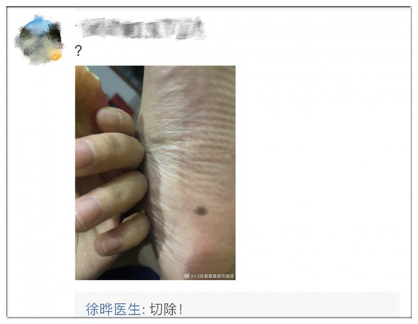 宝宝身上长这样的“痣”，千万别大意！