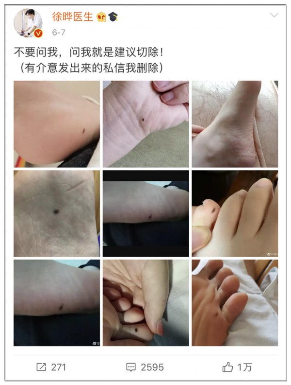 宝宝身上长这样的“痣”，千万别大意！