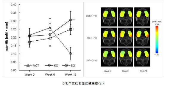 活力满格，思维在线 | 健康老龄化浪潮下，阿克人类营养如何用“全维矩阵”守护银发脑健康？