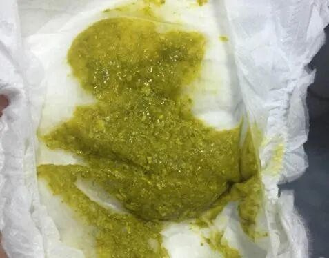 喝水解奶粉，拒奶、绿便、拉便少、吐奶反流、一个月15听...居然都是正常的？