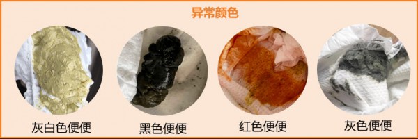 宝宝一天便便几次才正常？性状、颜色、次数…5步炼成“鉴屎官”！